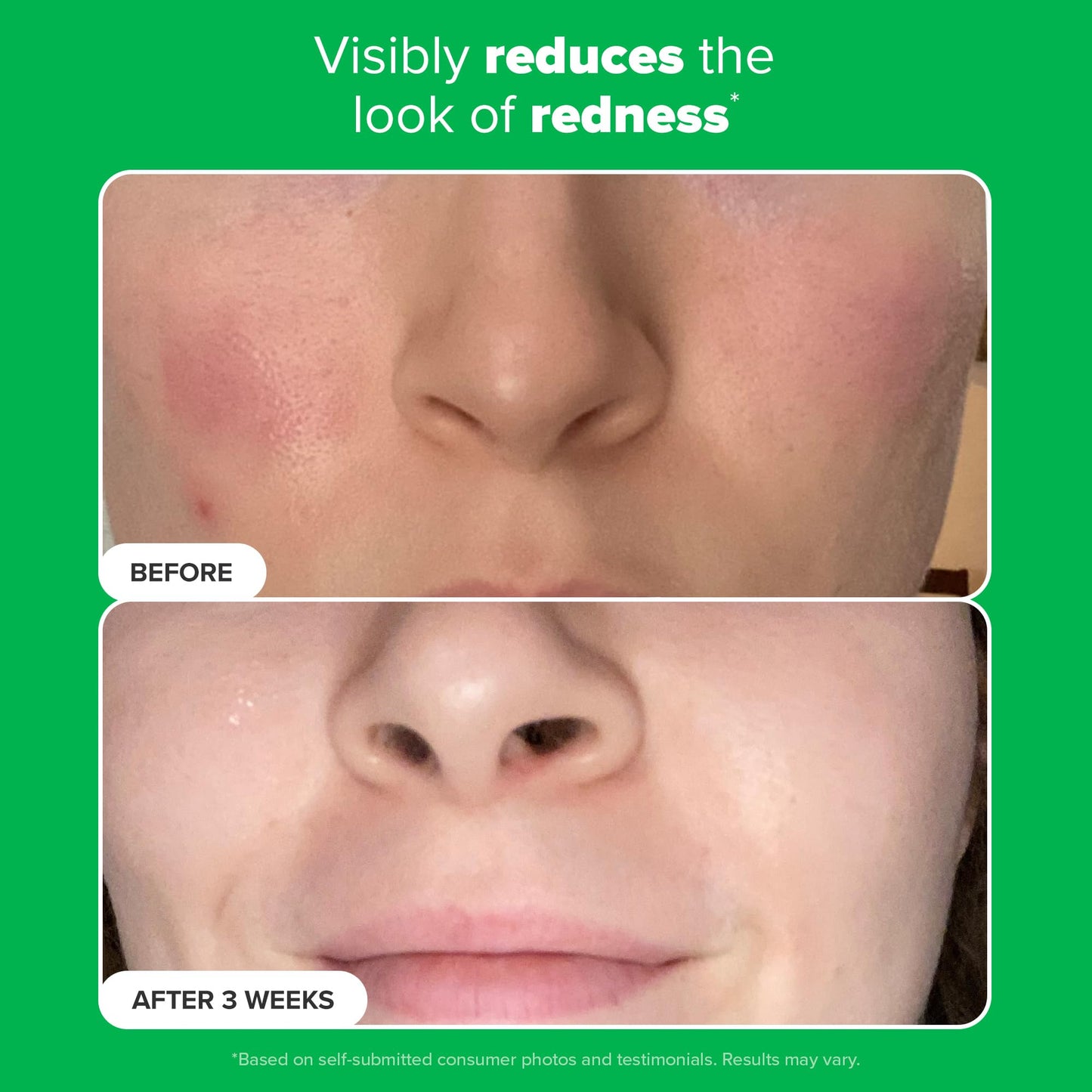 Paula's Choice BOOST 10% Azelaic Acid Booster Cream Gel, Licorice Extract & Salicylic Acid, Oil-Free Skin Brightening Serum, 1 Ounce